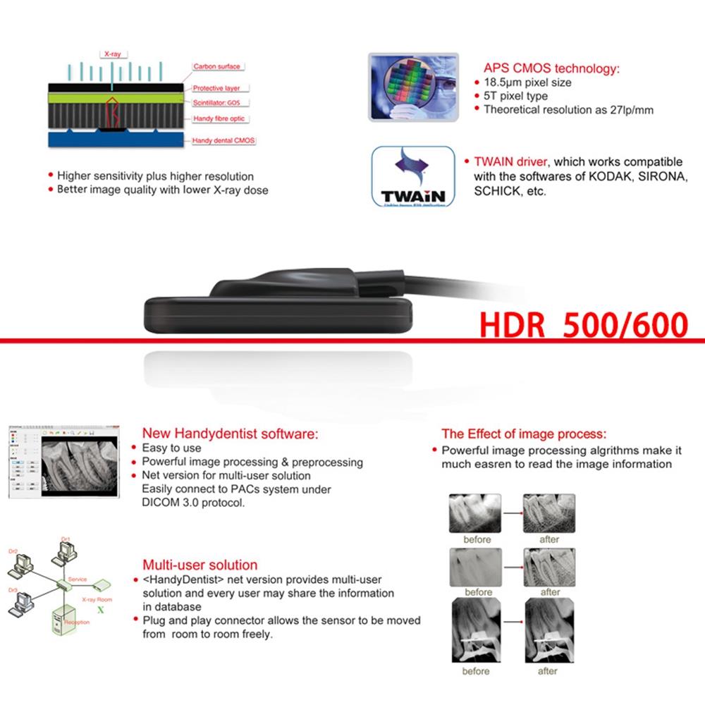 HDR-600 Dental Sensor Digital X-ray Intraoral Sensor CMOS APS High Frequency RVG Imaging System