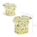 Dental Implant Disease Teeth Model with Restoration & Bridge Tooth Model Demonstration With Removable Tooth