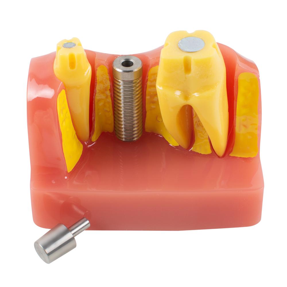 Dimostrazione dentale Denti Modello Analisi dell'impianto Crown Bridge