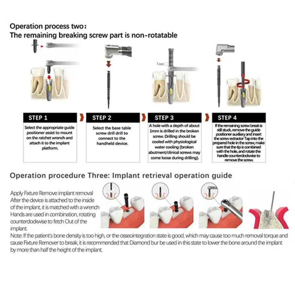 Dental Broken Screw Remover Implant Pickup Kit Implant Ratchet Wrench