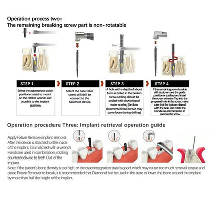 Dental Broken Screw Remover Implant Pickup Kit Implant Ratchet Wrench