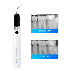 Opération ultrasonique sans fil dentaire Endo Activateur ultrasonique
